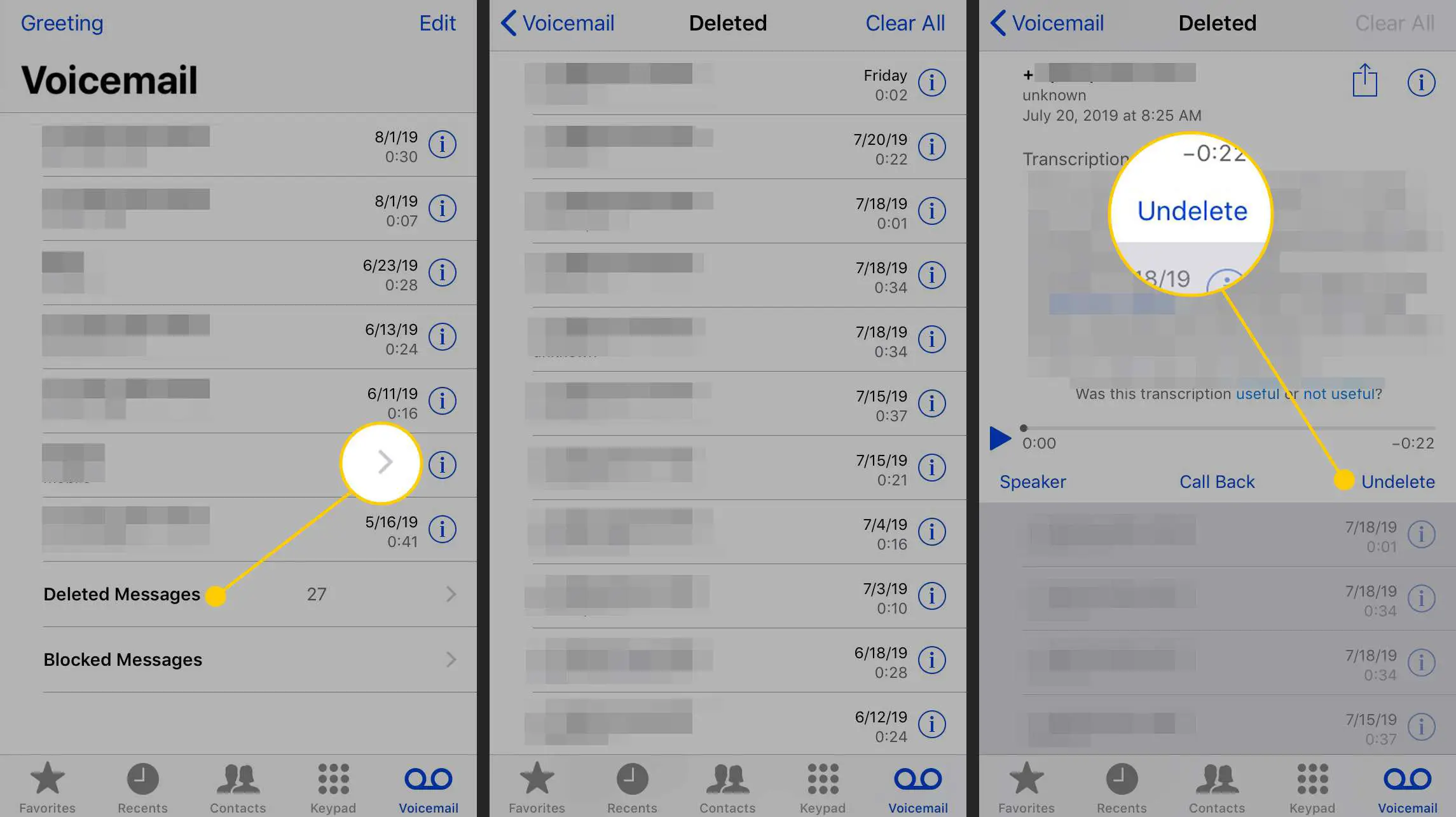 Tela de correio de voz, tela excluída e botão Desfazer exclusão em um iPhone