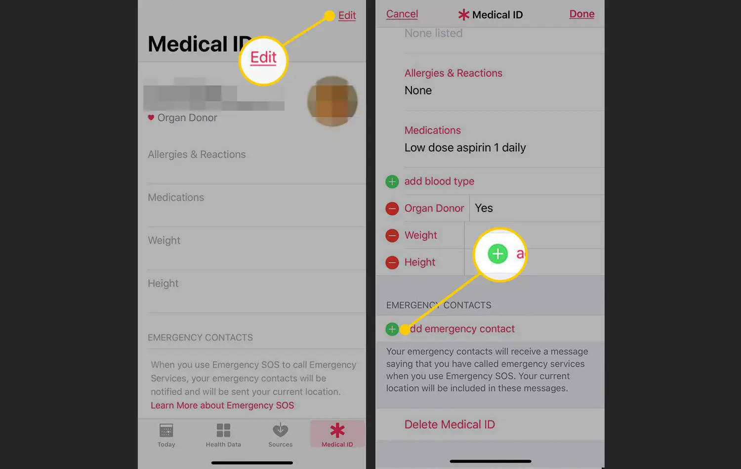 Editar ID Médica em um iPhone